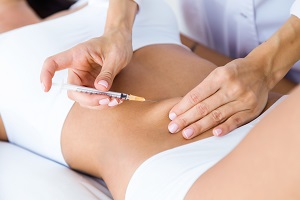 Mesoterapia, como tratamiento estético 