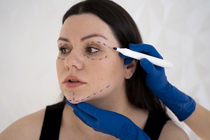 las Micro-infiltraciones, como tratamiento estético 